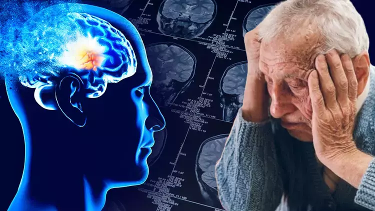 Alzheimer’da erken teşhis: yüzde 95 doğruluk sağlıyor 1 598556