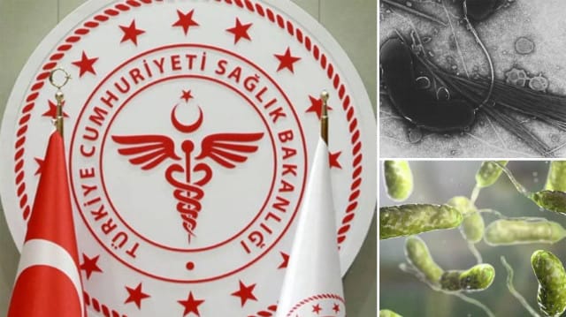 Türkiye’de ‘et yiyen bakteri’ vakası görüldü mü? 1 türkiyede et yiyen bakteri